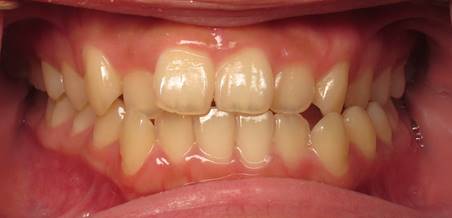 Dental Midlines